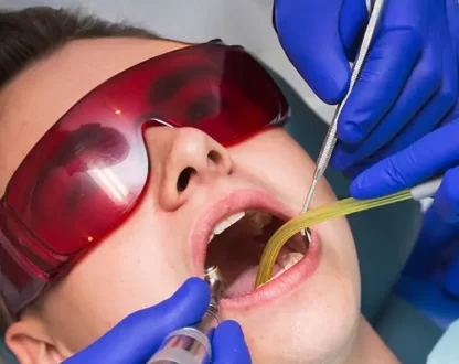 What to Expect During and After a Tooth Extraction: A Complete Guide