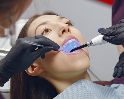 How Often Should You Get a Dental Cleaning? What Experts Recommend?