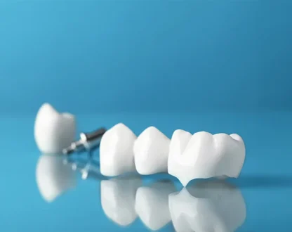 How Professional Cleanings Help Protect Dental Work Like Crowns and Fillings